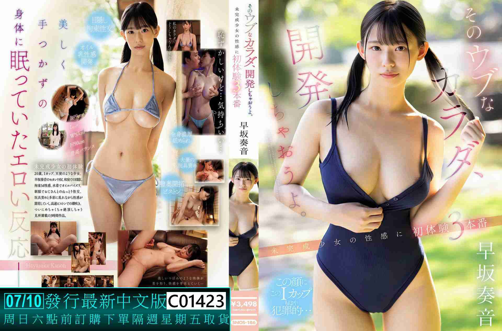 C01423